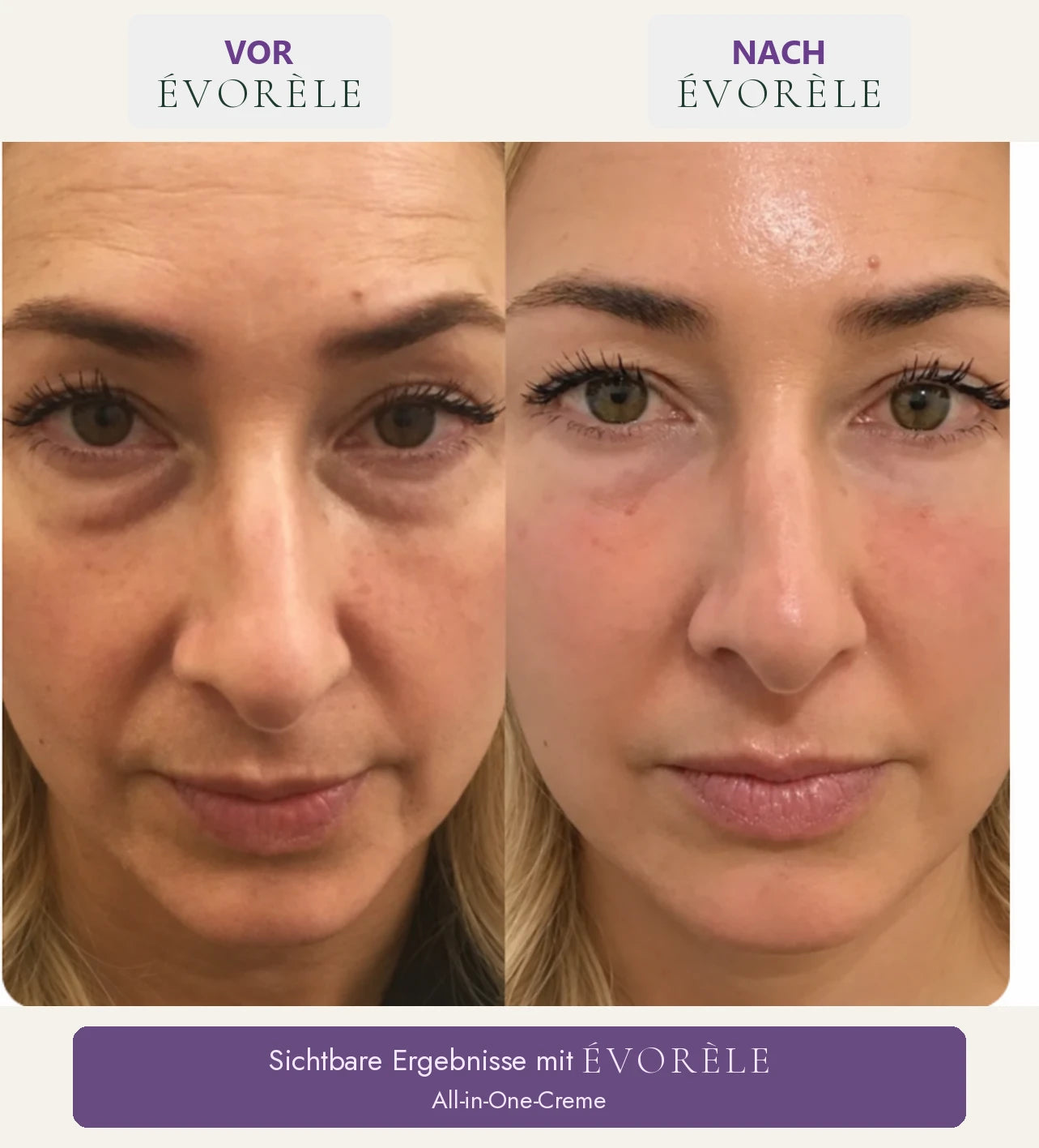 Vorher-Nachher-Foto: All-in-One-Creme