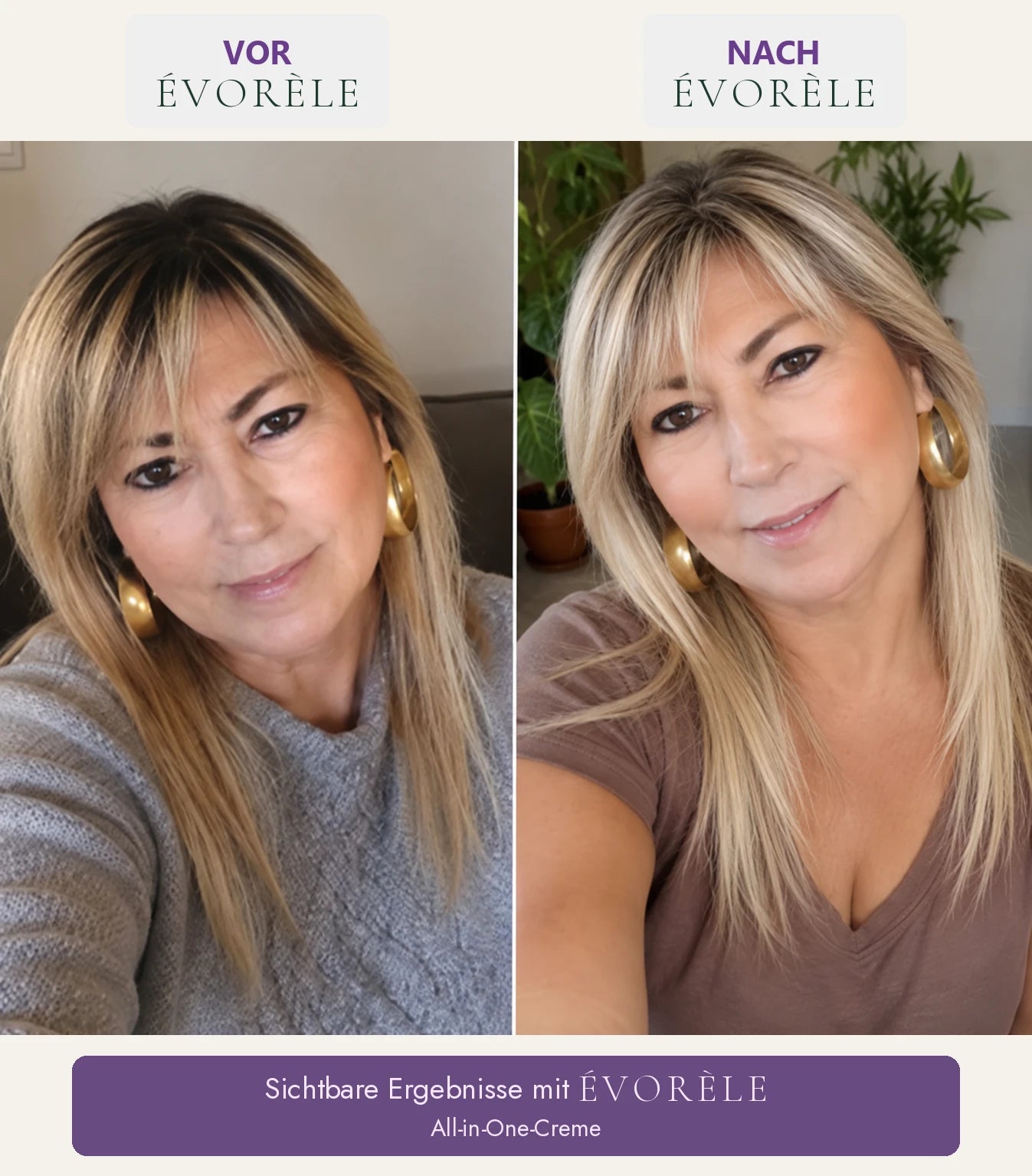 Vorher-Nachher-Foto: All-in-One-Creme