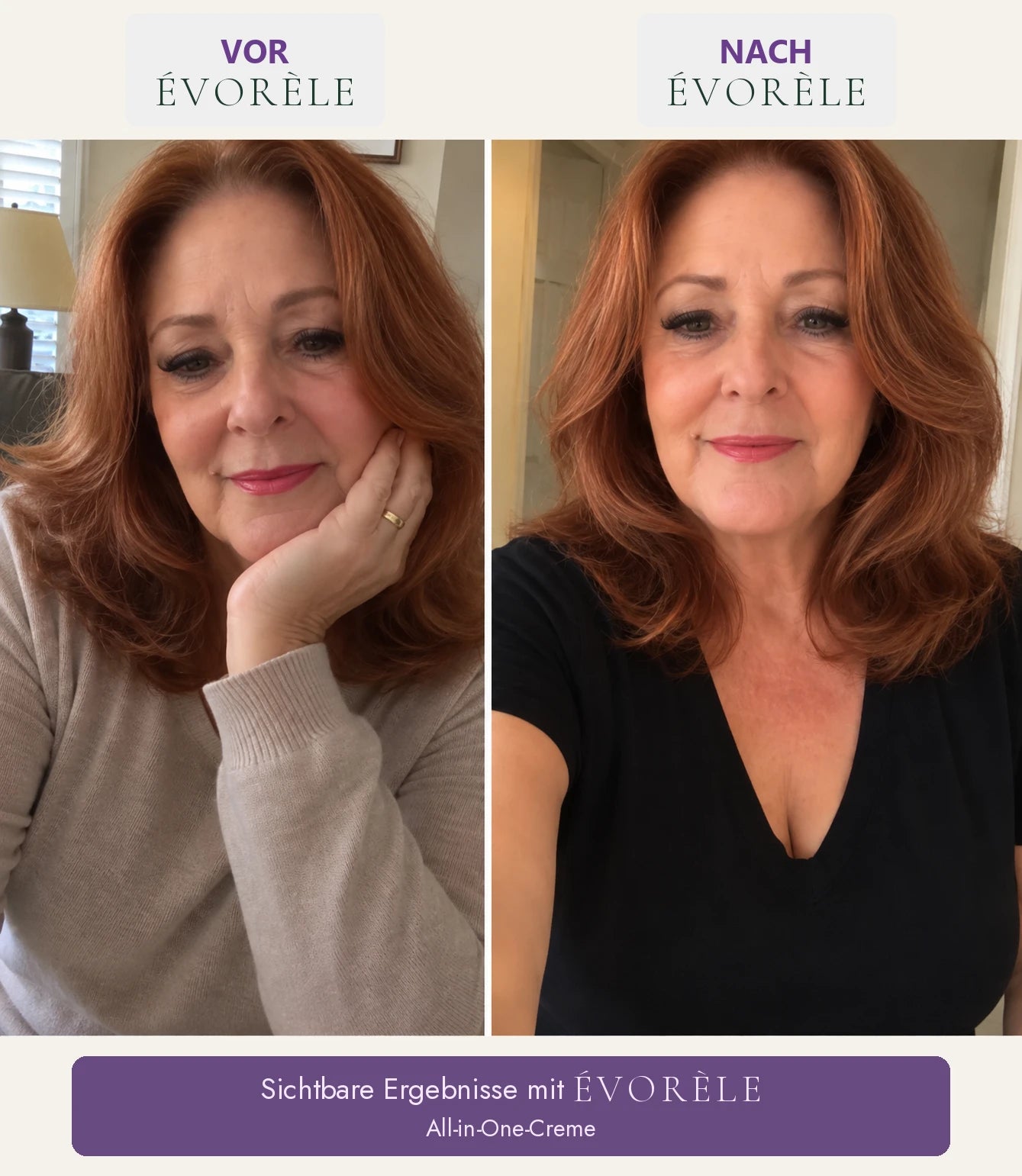 Vorher-Nachher-Foto: All-in-One-Creme