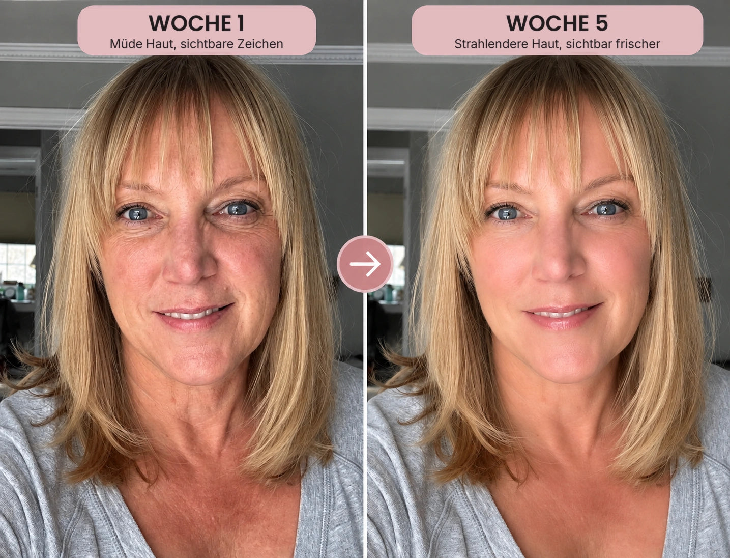 Vorher-Nachher-Foto: Kollagen-Serum