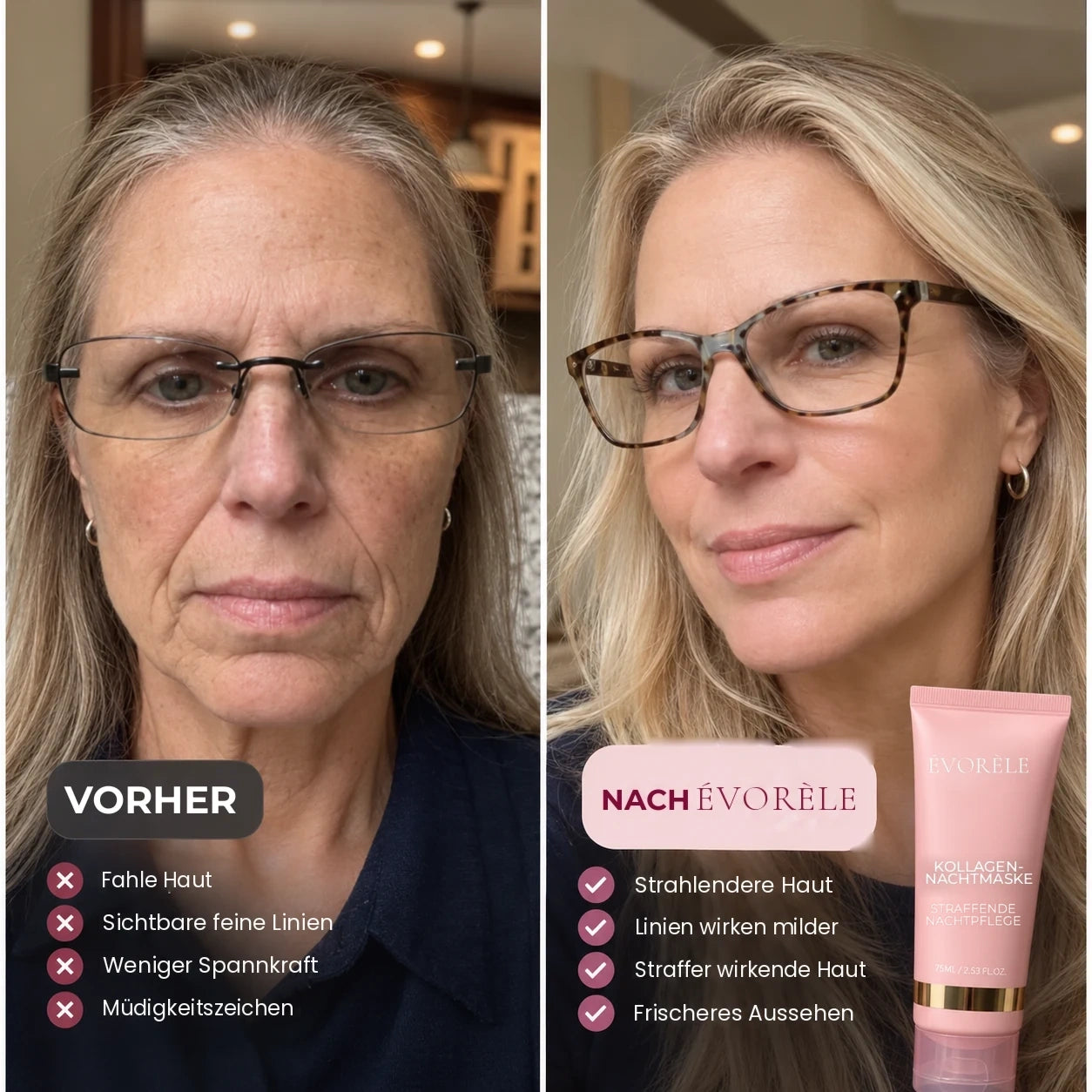 Vorher-Nachher-Foto: Kollagen-Nachtmaske