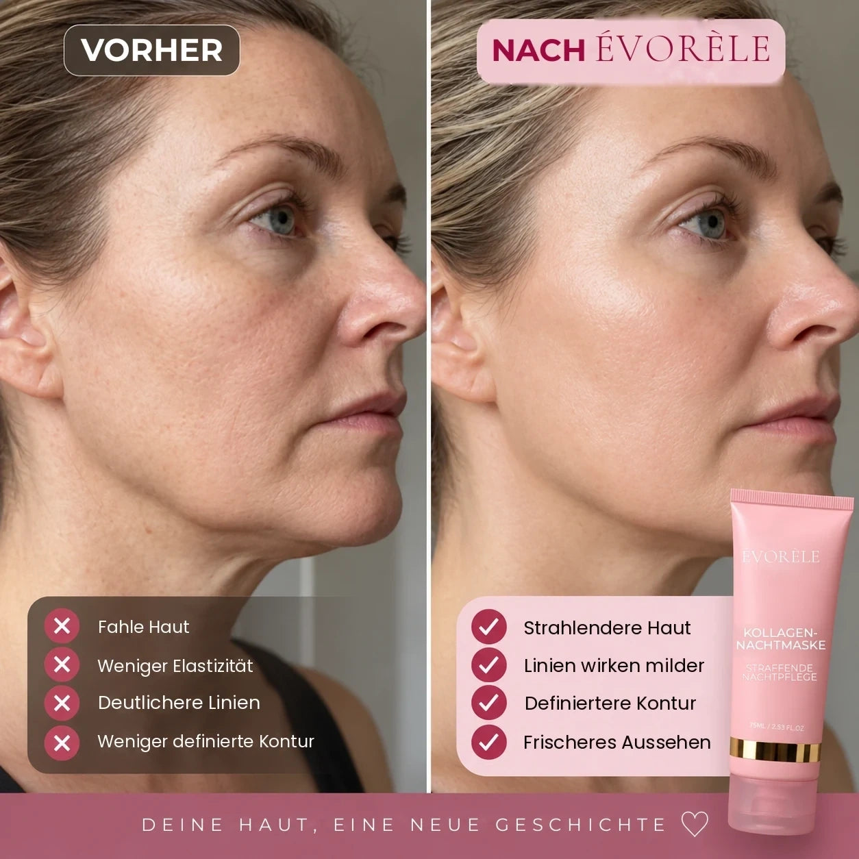 Vorher-Nachher-Foto: Kollagen-Nachtmaske