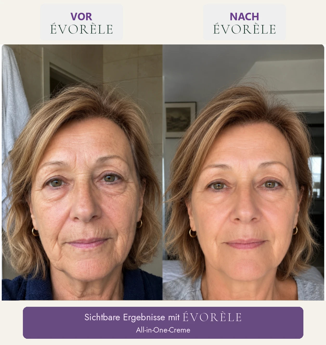 Vorher-Nachher-Foto: All-in-One-Creme