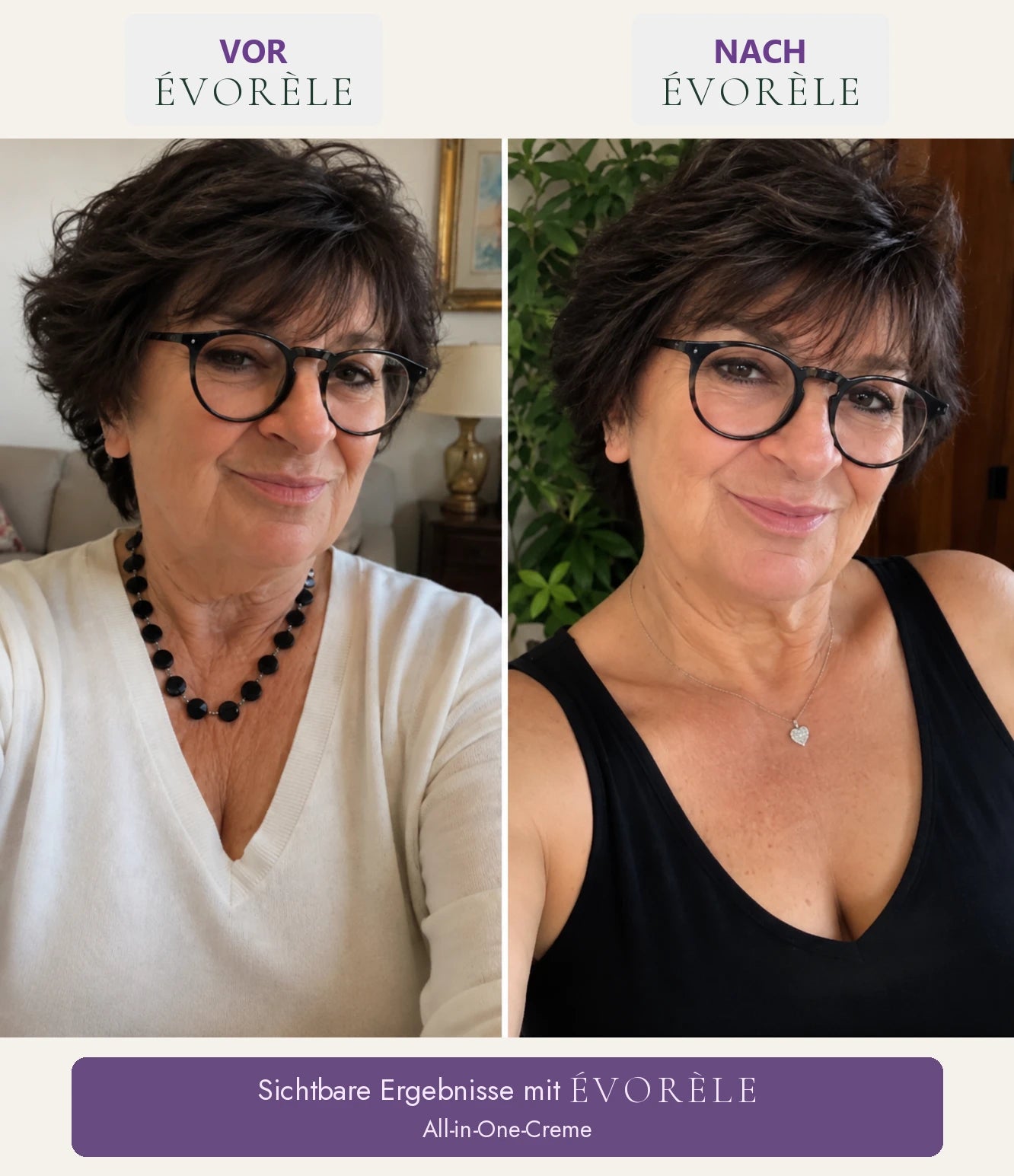 Vorher-Nachher-Foto: All-in-One-Creme