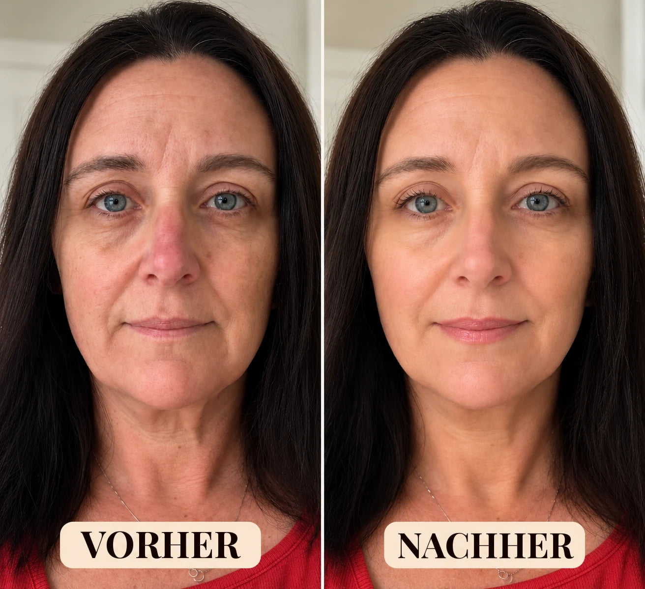 Vorher/Nachher mit der Adaptive Foundation