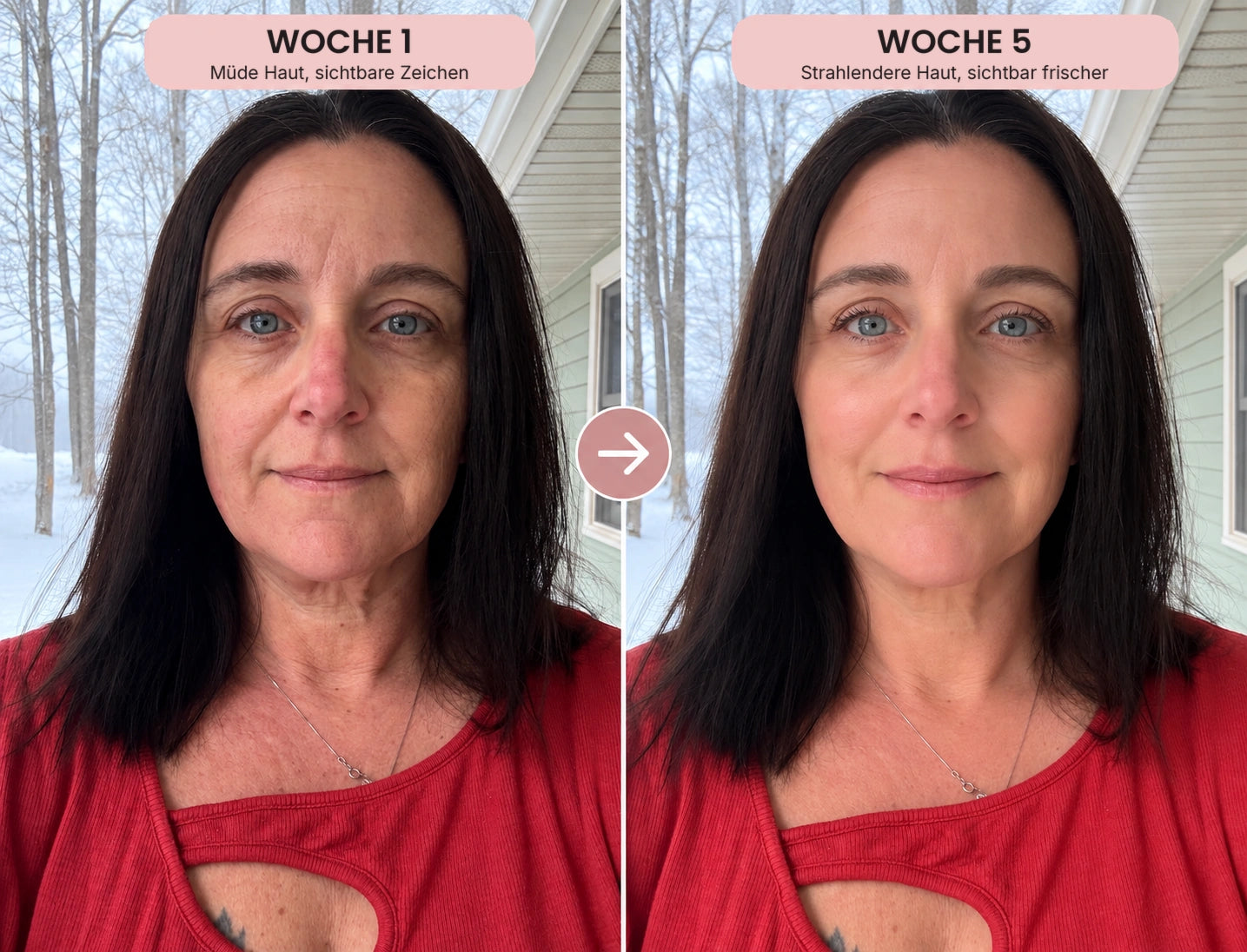 Vorher-Nachher-Foto: Kollagen-Serum