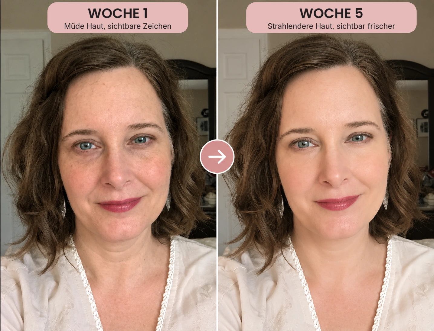Vorher-Nachher-Foto: Kollagen-Serum