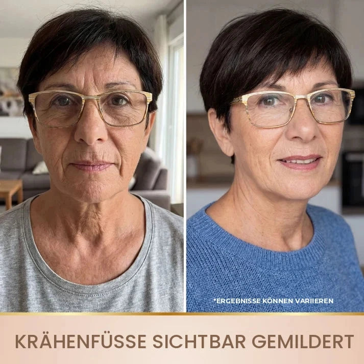 Lifting-Serum – Bild 8