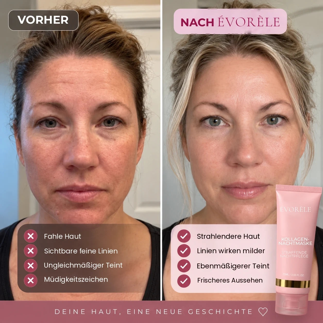Vorher-Nachher-Foto: Kollagen-Nachtmaske