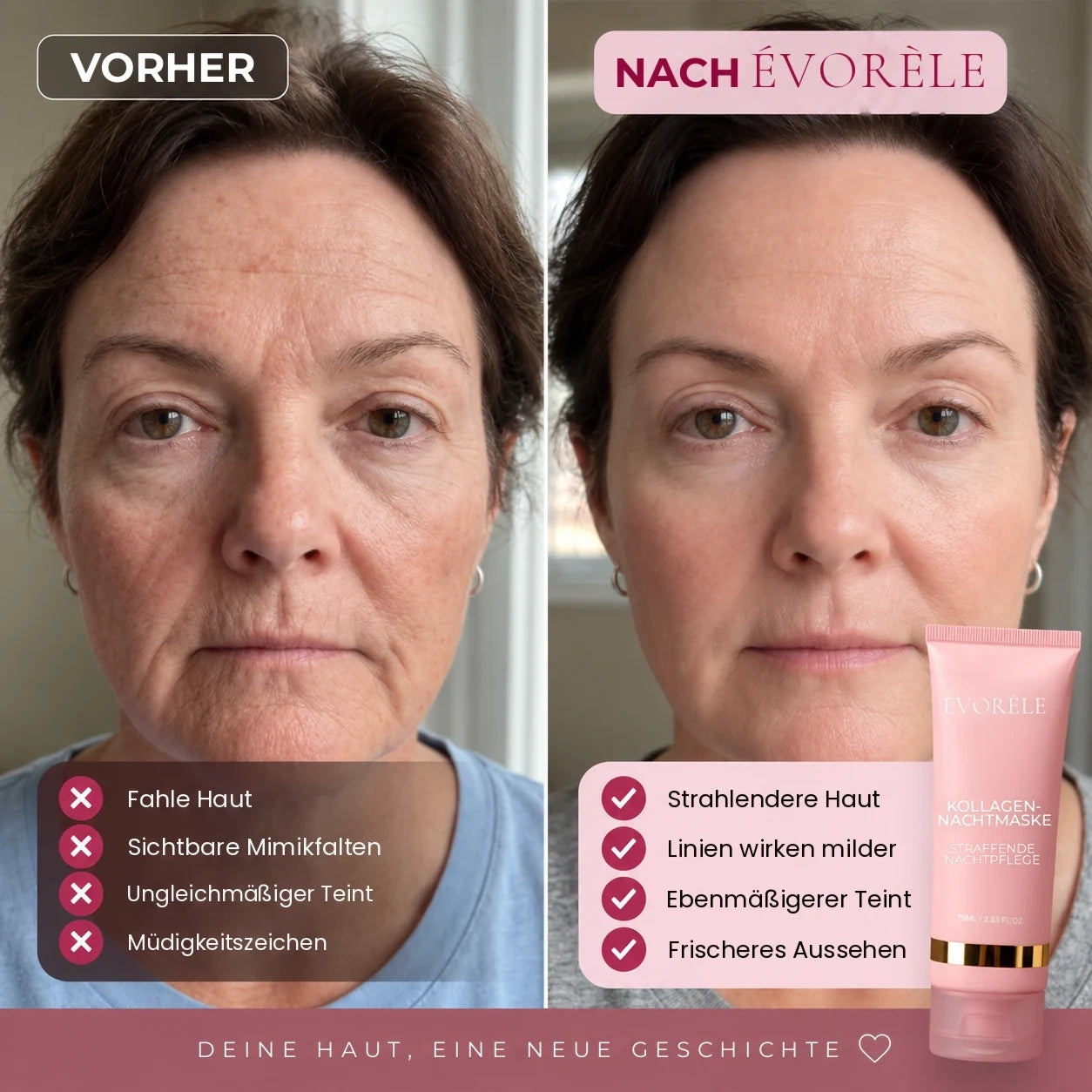 Vorher-Nachher-Foto: Kollagen-Nachtmaske