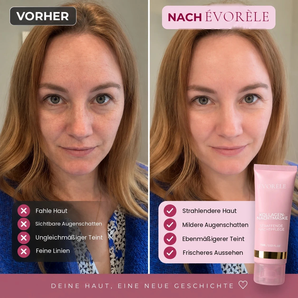 Vorher-Nachher-Foto: Kollagen-Nachtmaske