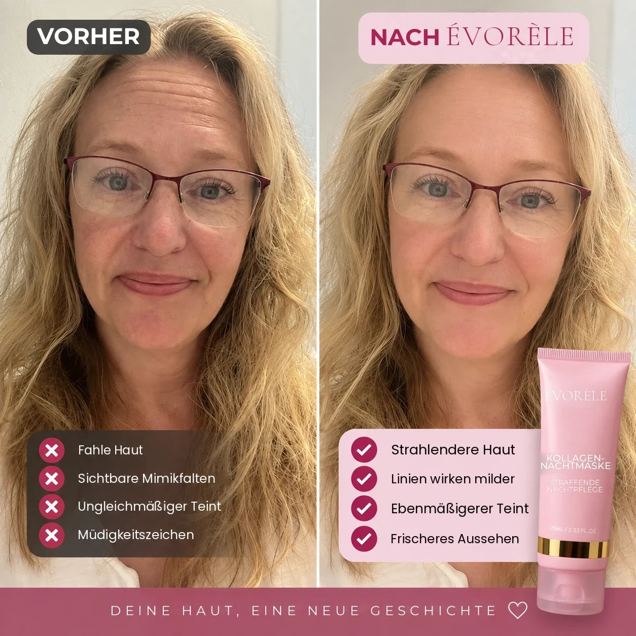 Vorher-Nachher-Foto: Kollagen-Nachtmaske